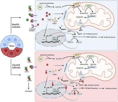Vitamin D and chronic kidney disease: Insights on lipid metabolism of tubular epithelial cell and macrophages in tubulointerstitial fibrosis